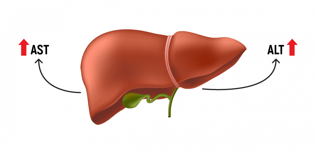 Hepastrong AMINO protects liver from fat accumulation. Ornithine cleans liver from toxic ammonia. Lowers ALT, AST. Prevents inflammation.
